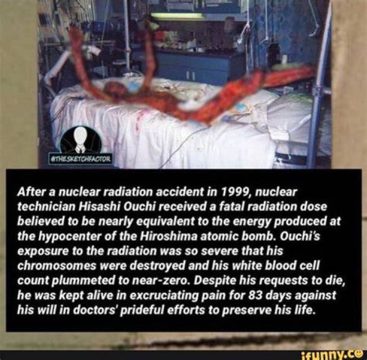 Hisashi Ouchi's Tragedy Creepypasta And Spookyism