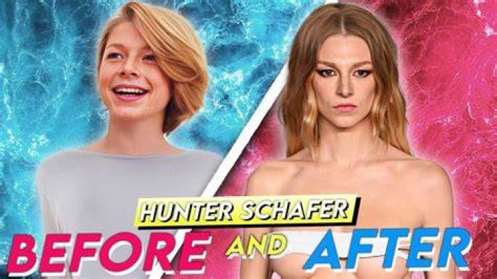 Understanding Hunter Schafer Surgery: A Deep Dive Into Her Journey
